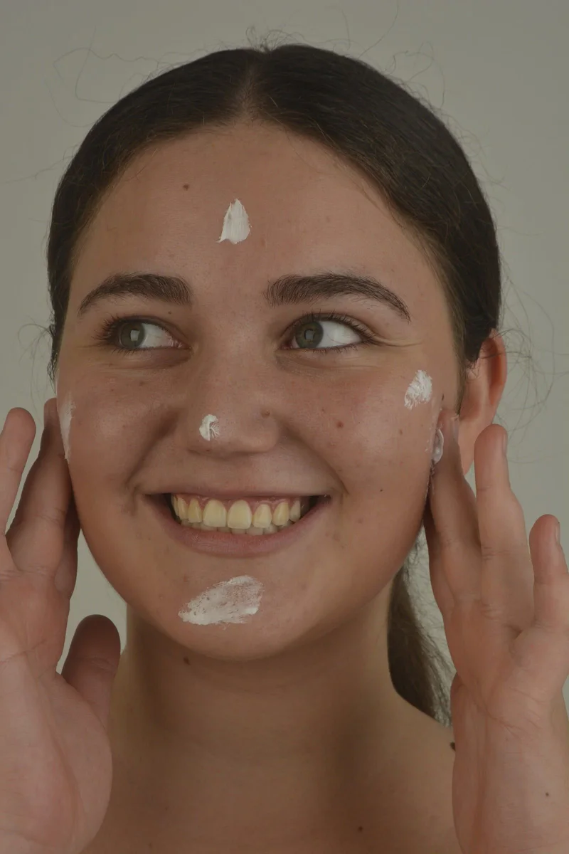 Modelo sonriente con puntos de crema en el rostro, sosteniéndose la cara con las manos